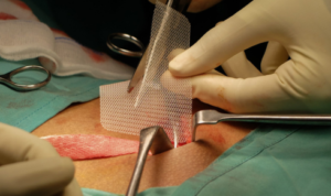 Surgery Without the Scare: A Real Take on Modern General Procedures